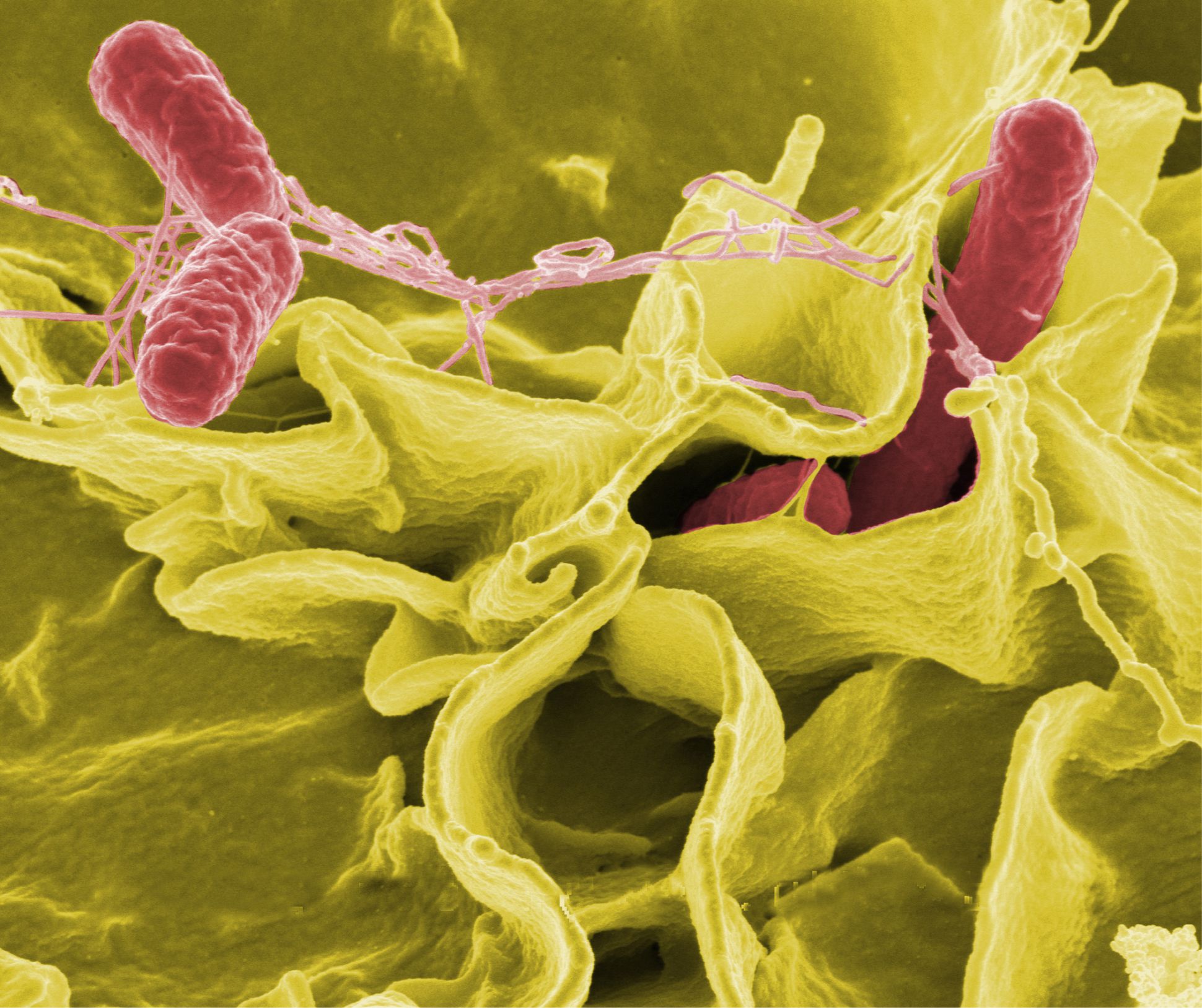 O QUE É SALMONELLA? ENTENDA O QUE FEZ A ANVISA PROIBIR A VENDA DE BALAS